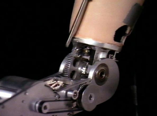 The "Boston Arm", a prosthetic elbow developed by MIT Professor Robert Mann.
