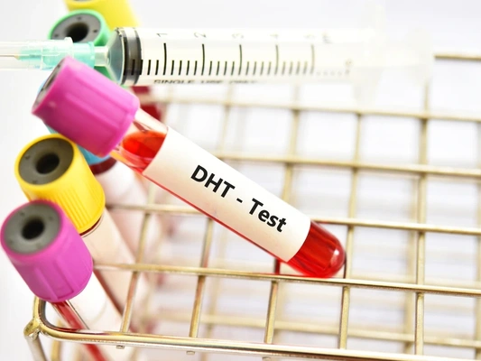 What Is A DHT Test? And Normal Results | STDWatch.com